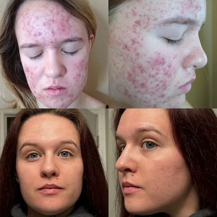 Dakotah Tyrene Esthetics Picture 8