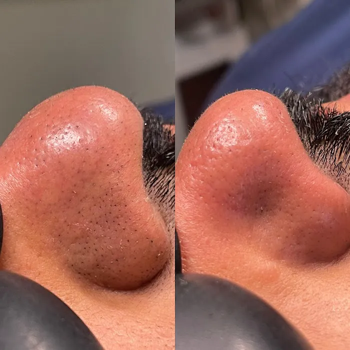 Dakotah Tyrene Esthetics Picture 7