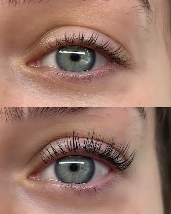 Dakotah Tyrene Esthetics Picture 5