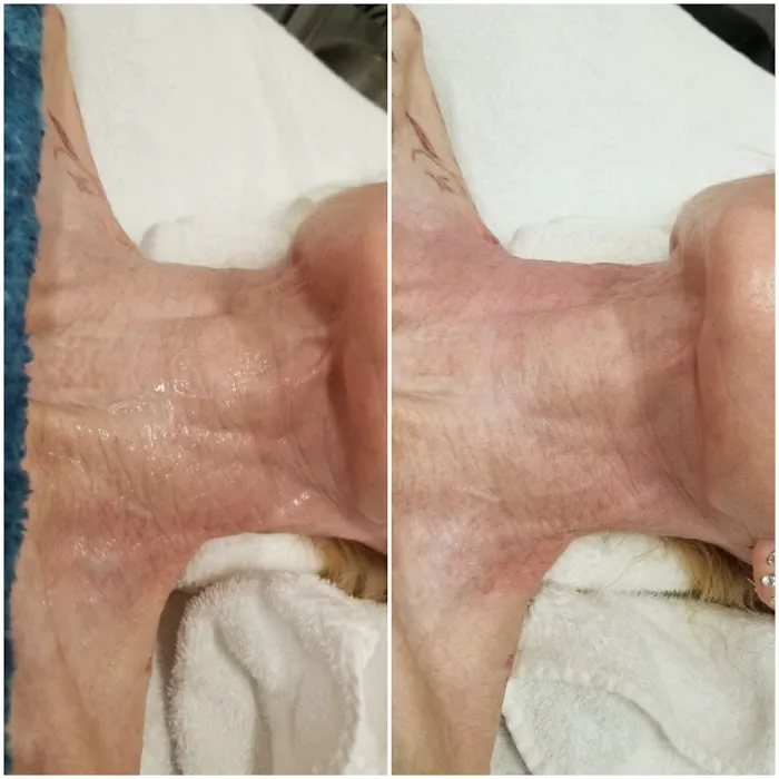 Appealing Peels Day Spa Picture 7