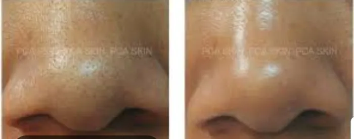 Appealing Peels Day Spa Picture 10