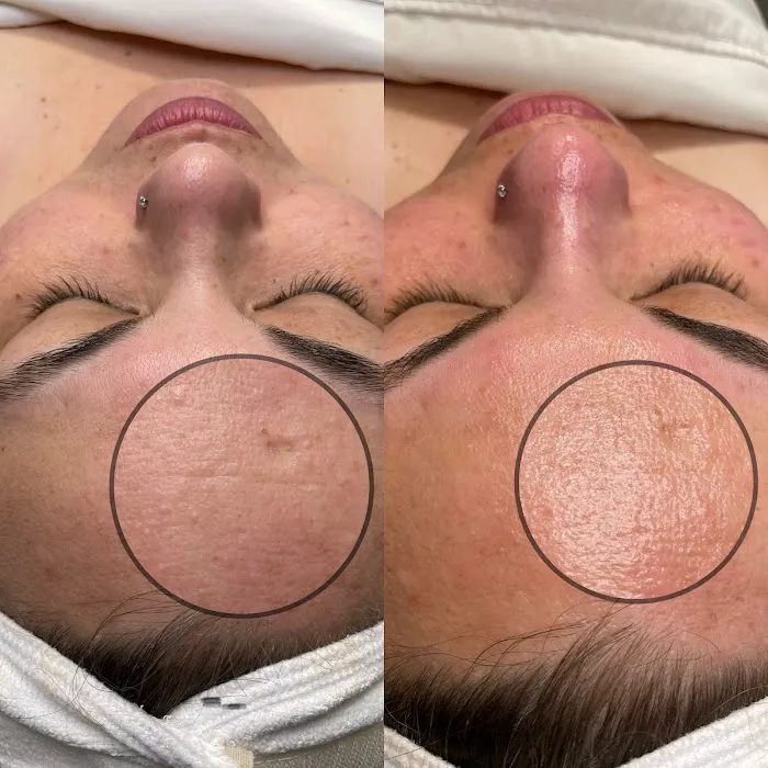 Belle Peau Esthetics Picture 3