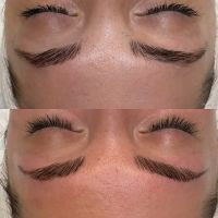 Belle Peau Esthetics ico