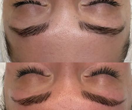 Belle Peau Esthetics