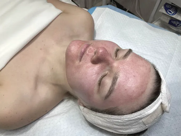 Belle Peau Esthetics Picture 7