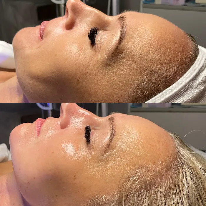 Belle Peau Esthetics Picture 8