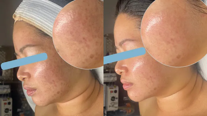 Que Liinda La Vida Picture 4