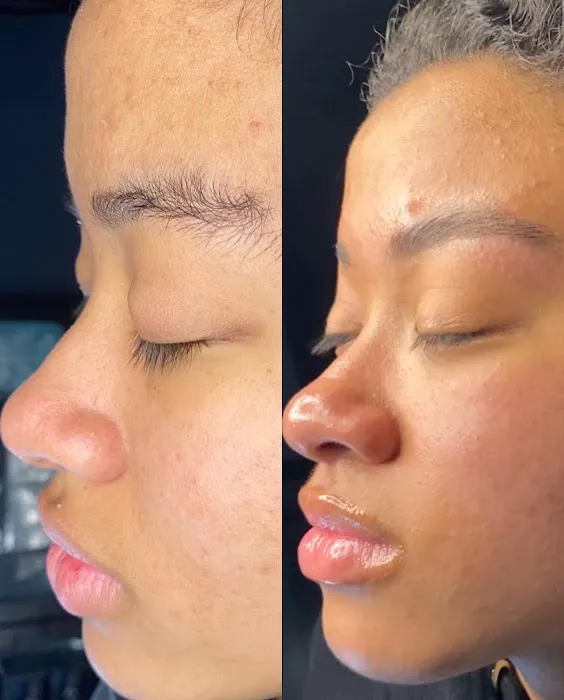 Que Liinda La Vida Picture 7