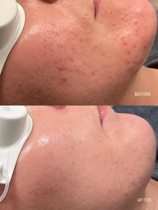 Blemish Studio Picture 3