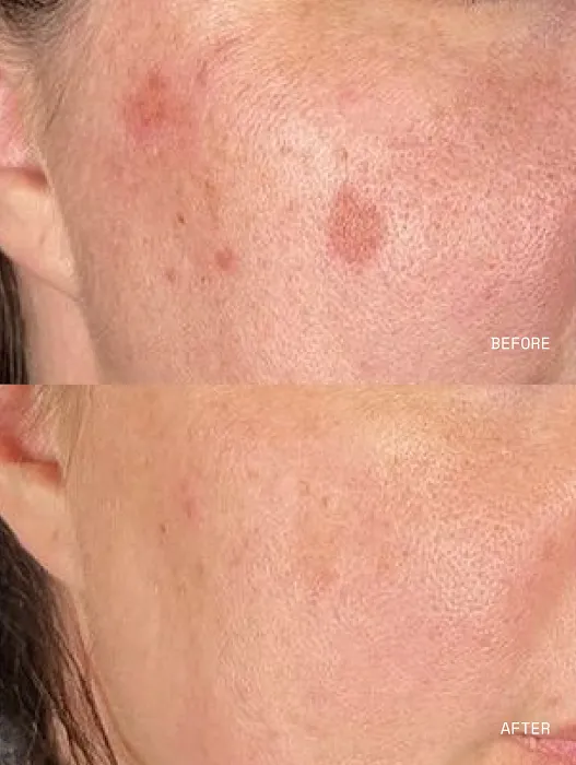 Blemish Studio Picture 5