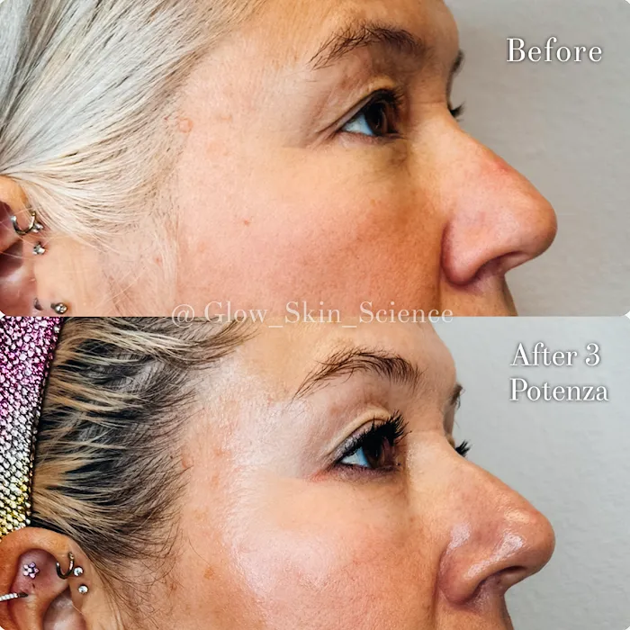 Glow Skin Science Picture 9