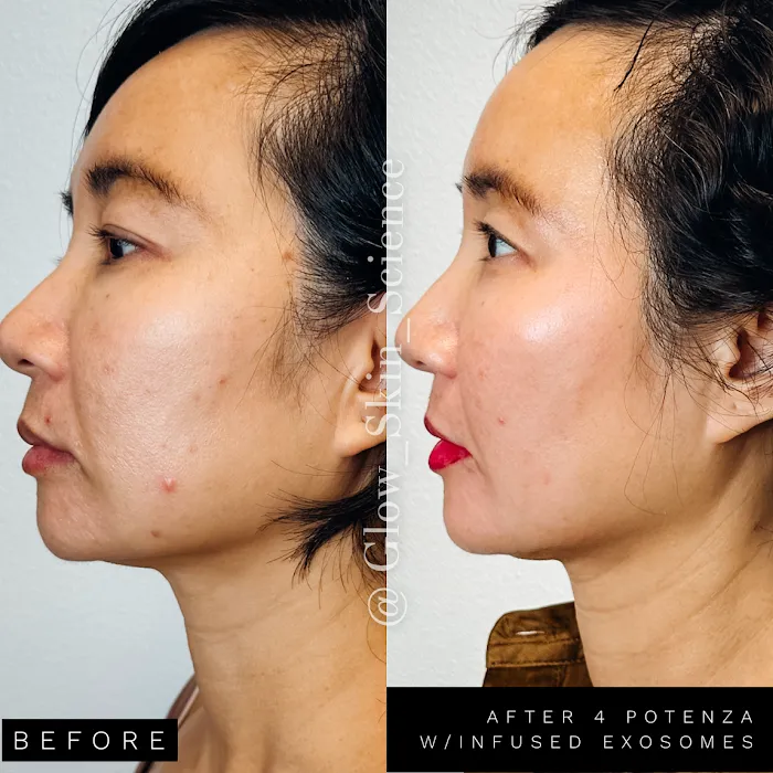 Glow Skin Science Picture 10