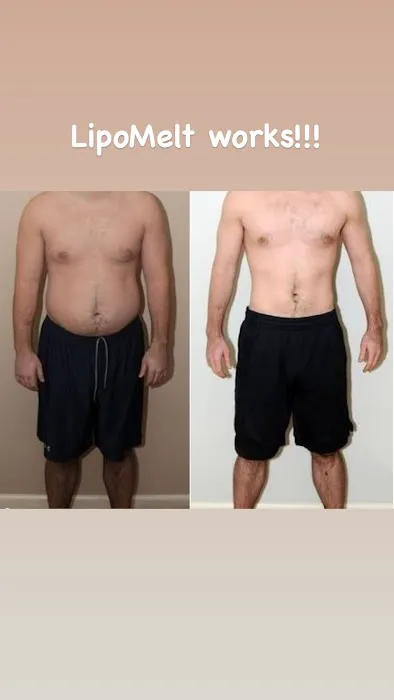 Eastside Esthetics Picture 4