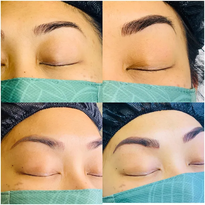 Skinluxe Browbar Picture 10