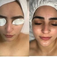 Miracle Esthetics ico