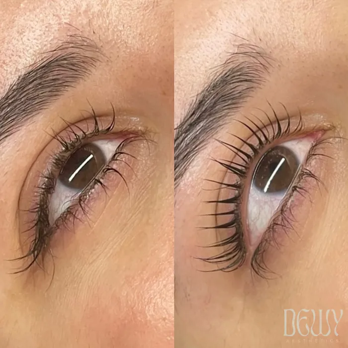 Dewy Aesthetics Picture 3