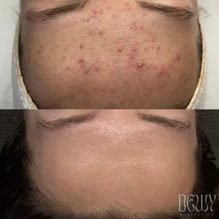 Dewy Aesthetics Picture 7