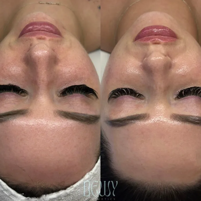 Dewy Aesthetics Picture 8