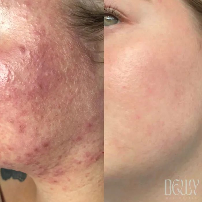 Dewy Aesthetics Picture 6