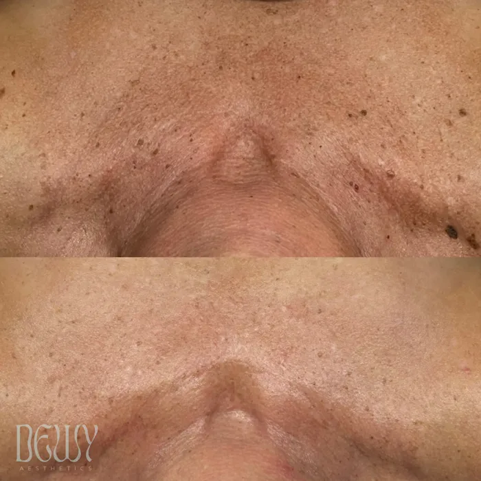 Dewy Aesthetics Picture 10