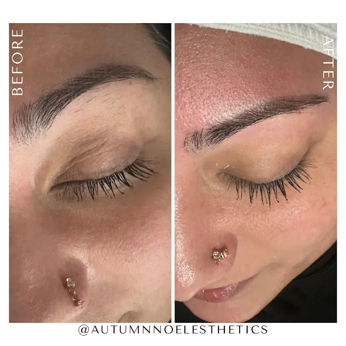 Autumn Noel Esthetics Picture 3