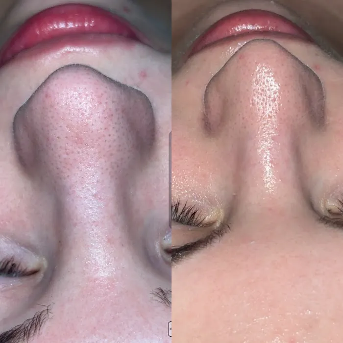 Afterglow Atelier Picture 5