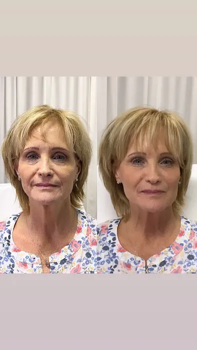 Aesthetics with Yelena Picture 5