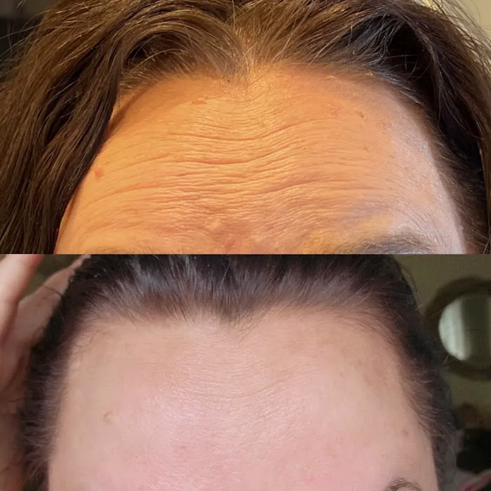 Aesthetics with Yelena Picture 4