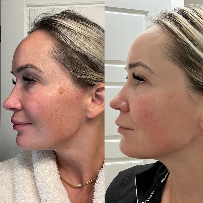 Aesthetics with Yelena Picture 3