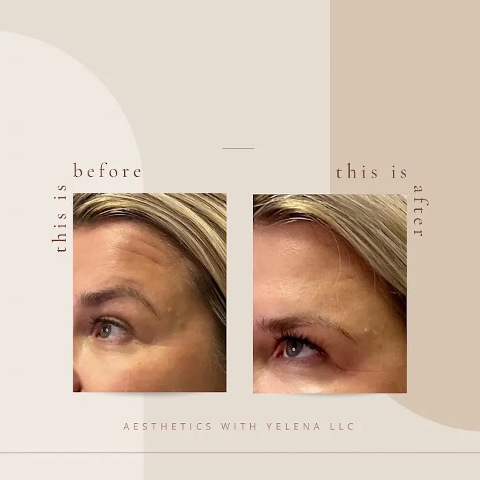 Aesthetics with Yelena Picture 8