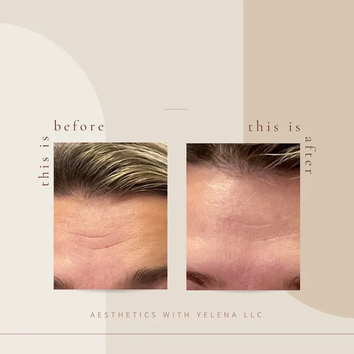 Aesthetics with Yelena Picture 9