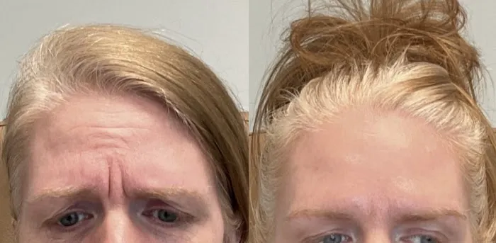 Aesthetics with Yelena Picture 6