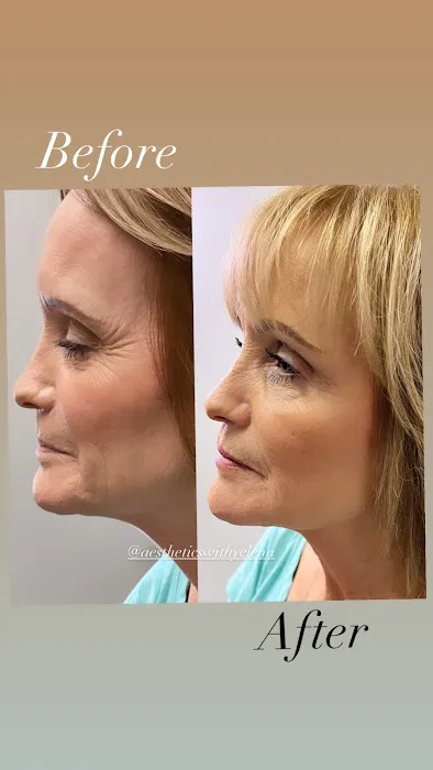 Aesthetics with Yelena Picture 10