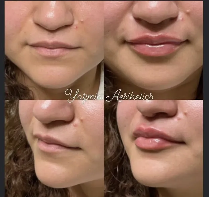 Yazmin Aesthetics Picture 5