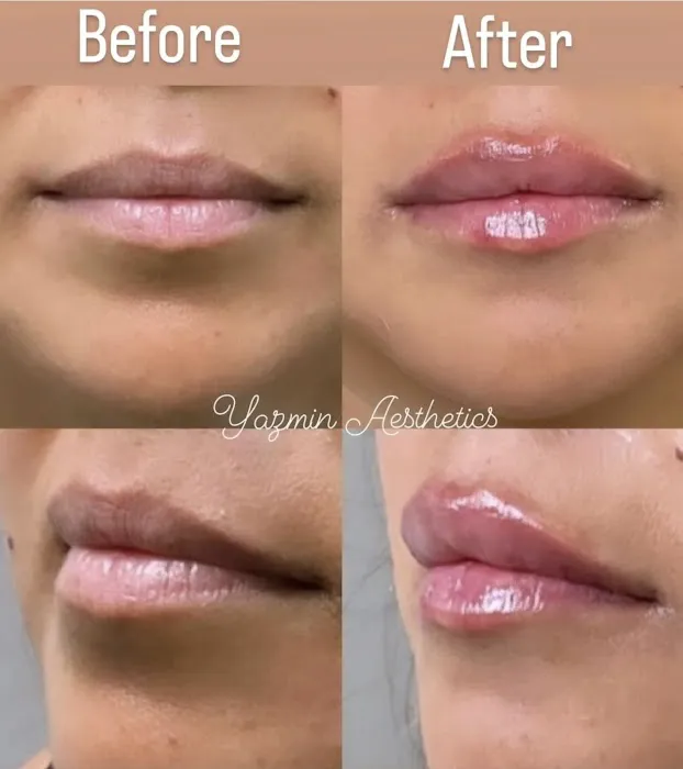 Yazmin Aesthetics Picture 9