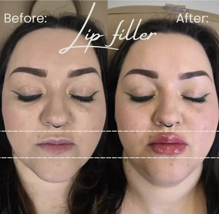 Yazmin Aesthetics Picture 10