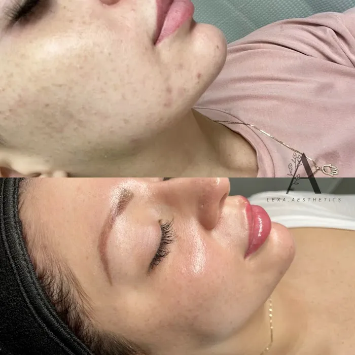 Lexa Aesthetics Picture 2