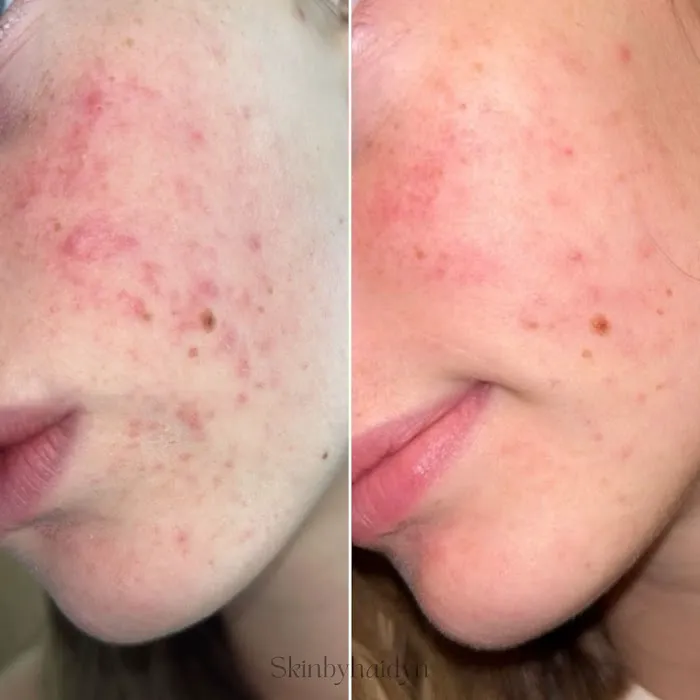 Skin By Haidyn Picture 6