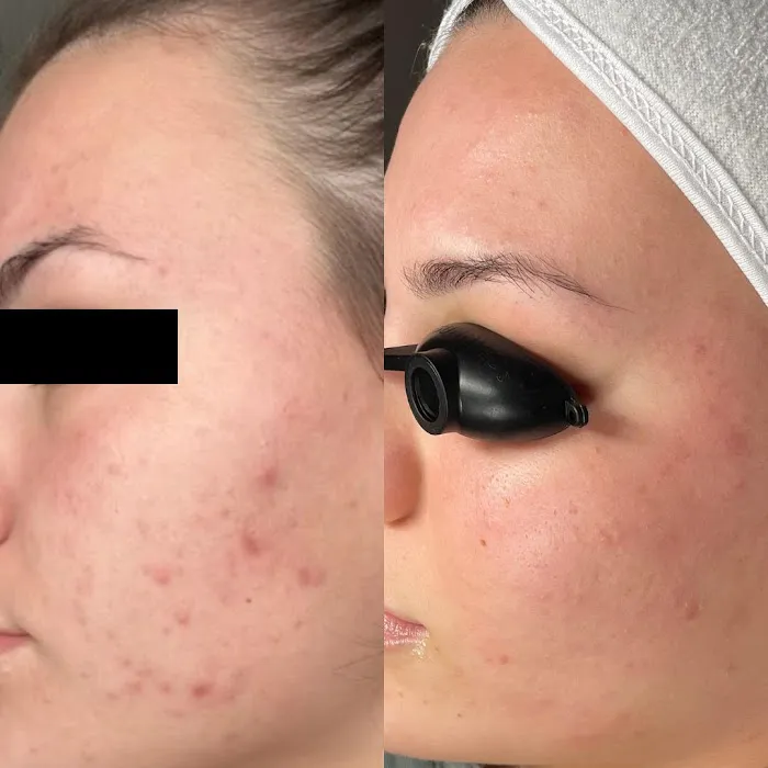 Skin By Haidyn Picture 3