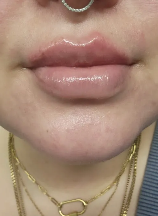 Arlington Medical Aesthetics Picture 7