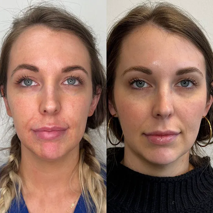 Maggie Colson, NP | Aesthetic Injectables & Skincare Picture 2