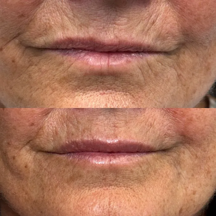 Maggie Colson, NP | Aesthetic Injectables & Skincare Picture 3