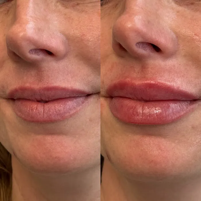 Maggie Colson, NP | Aesthetic Injectables & Skincare Picture 9