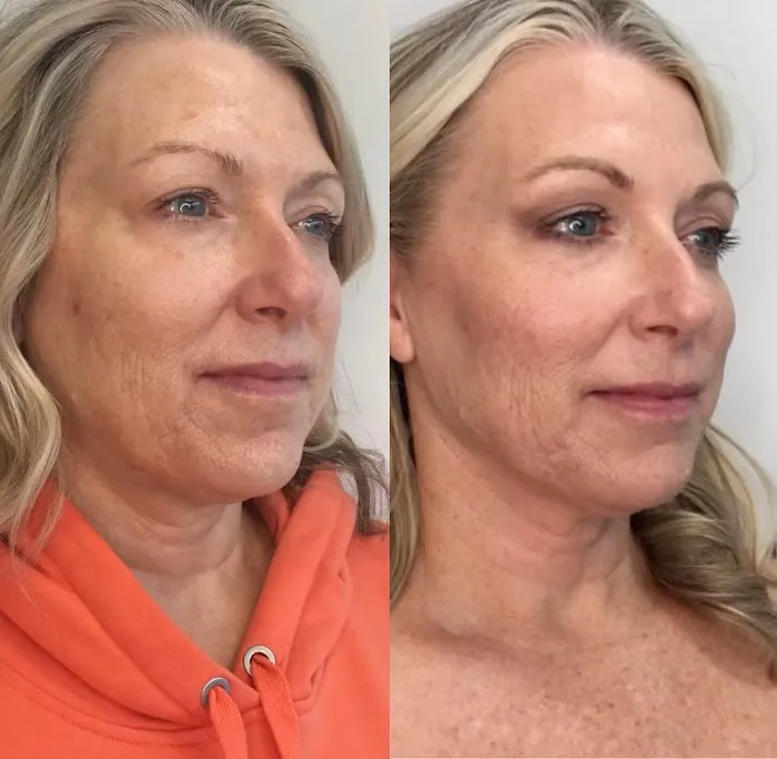 Maggie Colson, NP | Aesthetic Injectables & Skincare Picture 7