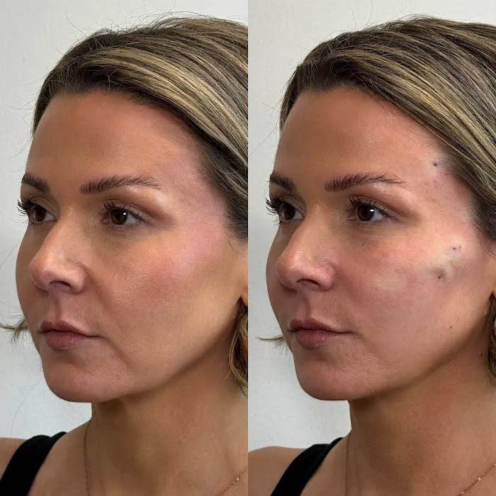 Maggie Colson, NP | Aesthetic Injectables & Skincare Picture 10