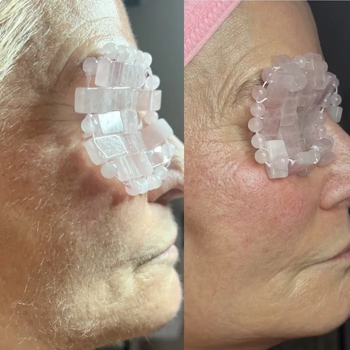 Esthétique Picture 2