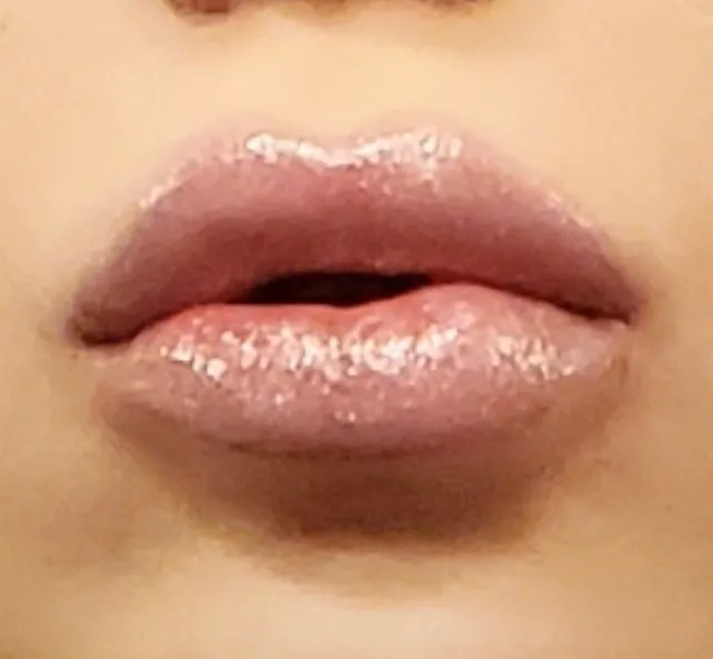 Botox Botixue Picture 1