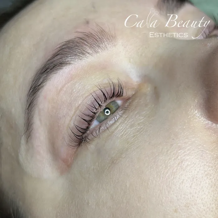 Calla Beauty Esthetics Picture 8