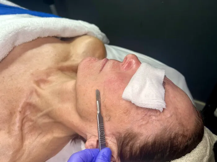 Tacoma Skin Care Picture 1