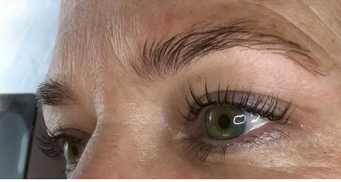 Tacoma Skin Care Picture 4